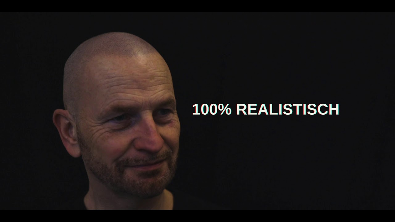 Micro haar pigmentatie specialist van NL! Nooit meer kaal met de stoppeltattoo.