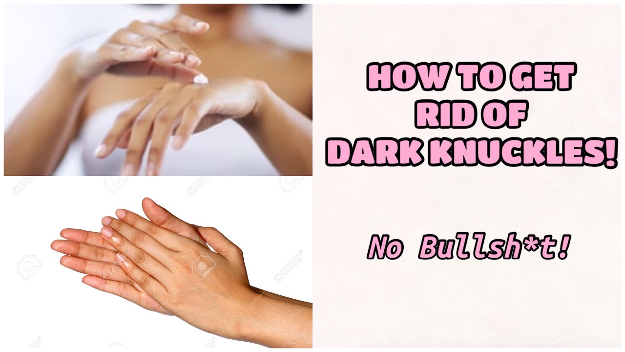 HOW TO GET RID OF DARK KNUCKLES FOREVER!