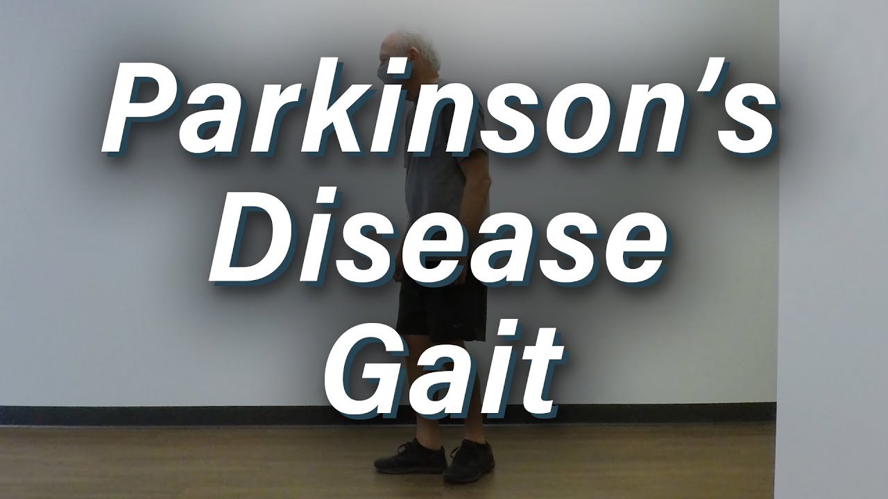 Parkinson's Disease Gait - Moderate Severity