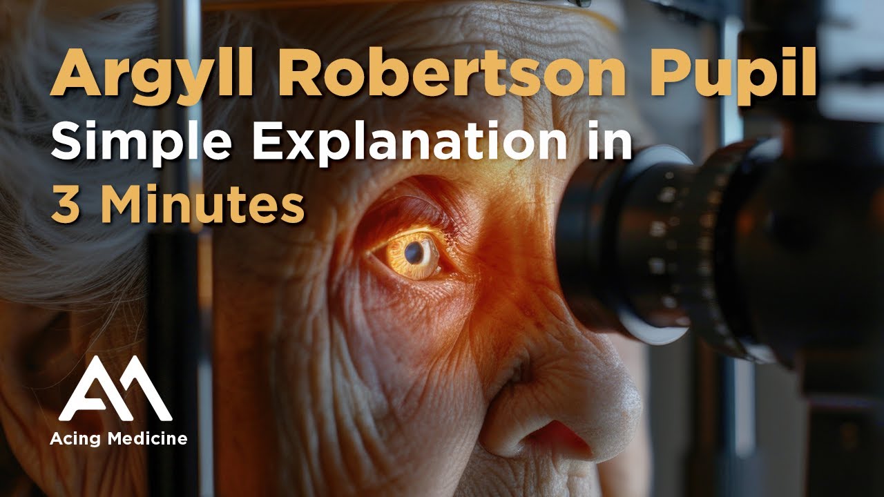 Argyll Robertson Pupil Explained in 3 Minutes | Acing Medicine