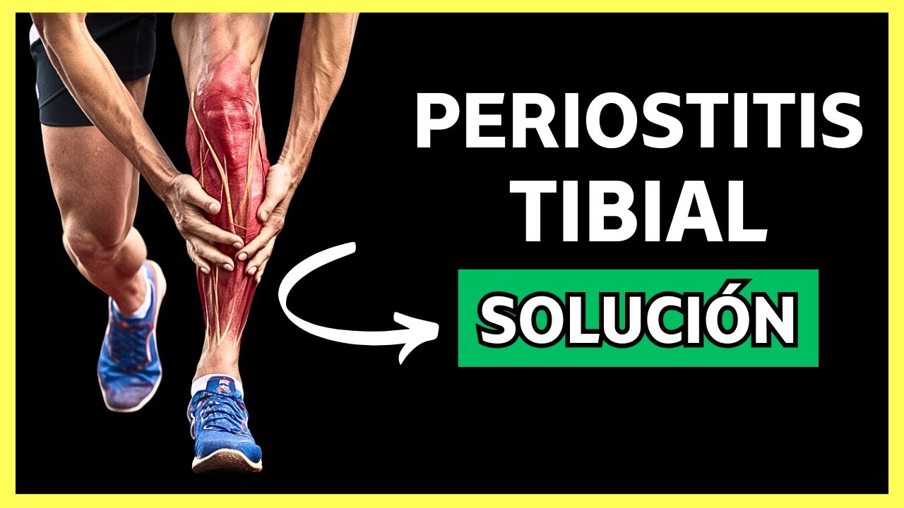 Guía Definitiva para CURAR la PERIOSTITIS TIBIAL (Paso a Paso)
