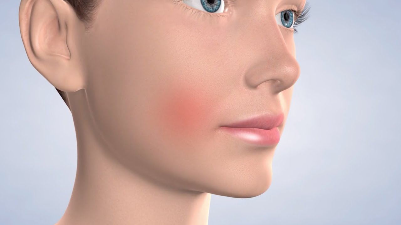 Post-Operative Instructions: Medication at Beacon Oral & Maxillofacial Surgeons