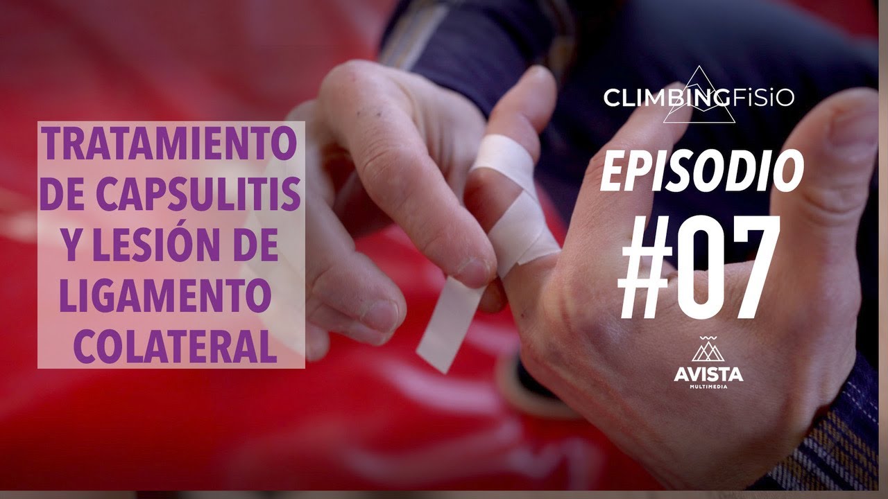 CLIMBINGFISIO EP 07 TRATAMIENTO DE LA CAPSULITIS