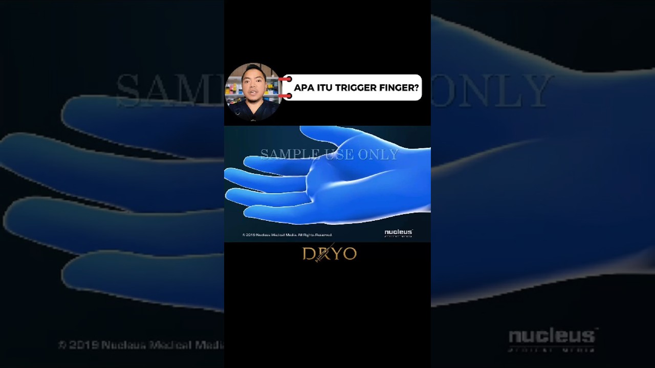 apa itu trigger finger? #DRYO #TriggerFinger #JariPelatuk #HandTherapy #Splint #TendonGliding