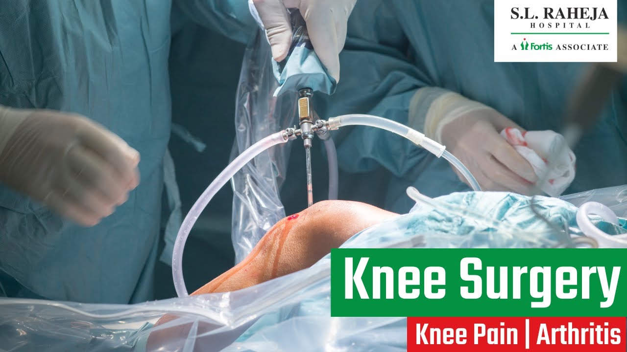 Knee Preservation Surgery in Young Age | Knee Pain | Arthritis | Knee Pain Relief |Knee Surgery| SLR