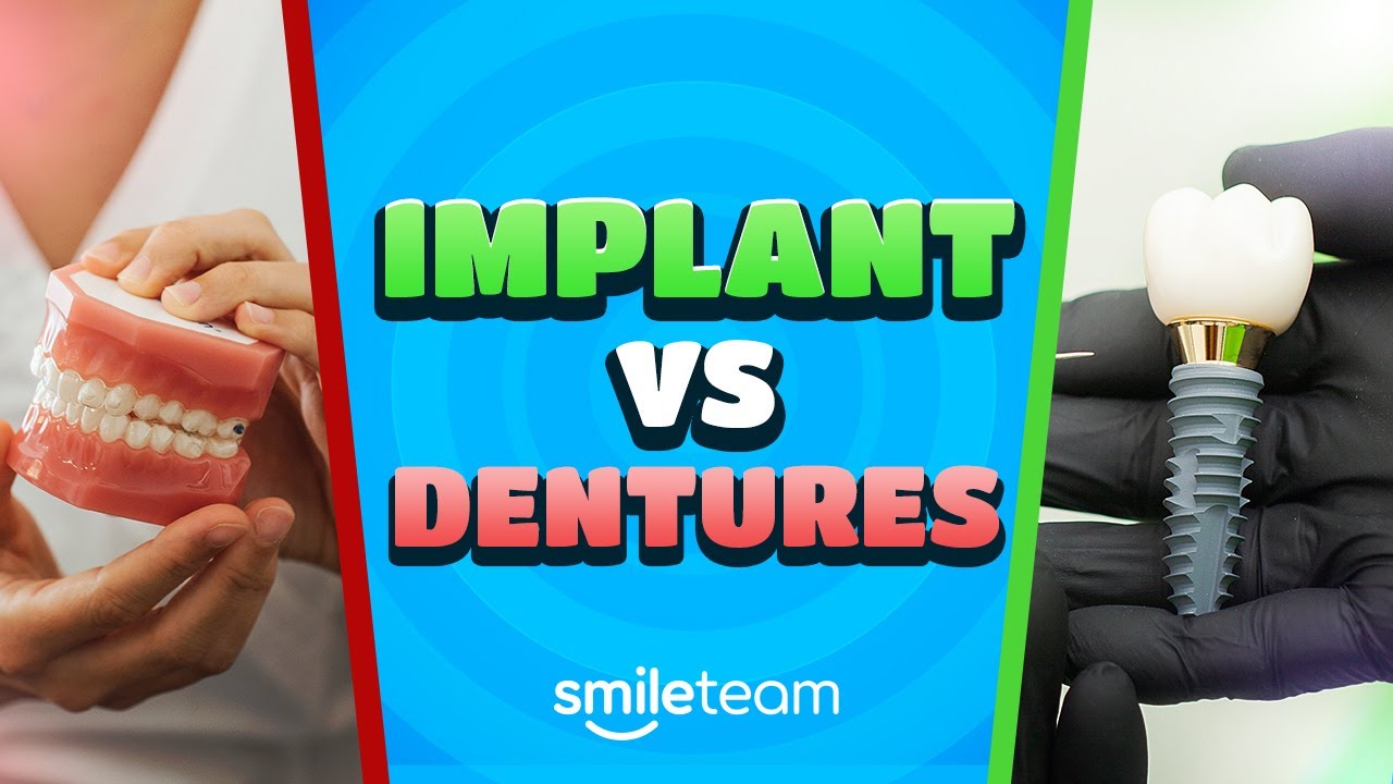 Pros and Cons of Dentures and Implants: Which Dental Solution Is Best for You?