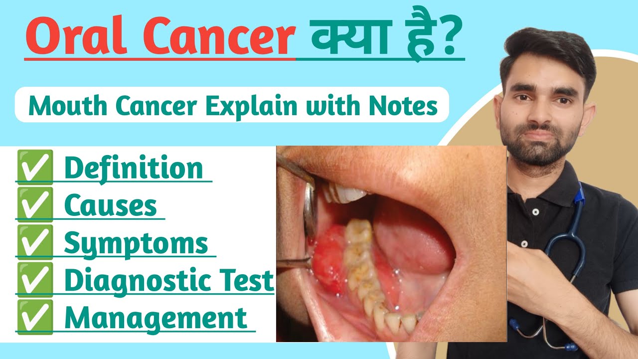 Oral Cancer Lecture in Hindi | Mouth Cancer kaise hota hai | Oncology in Hindi