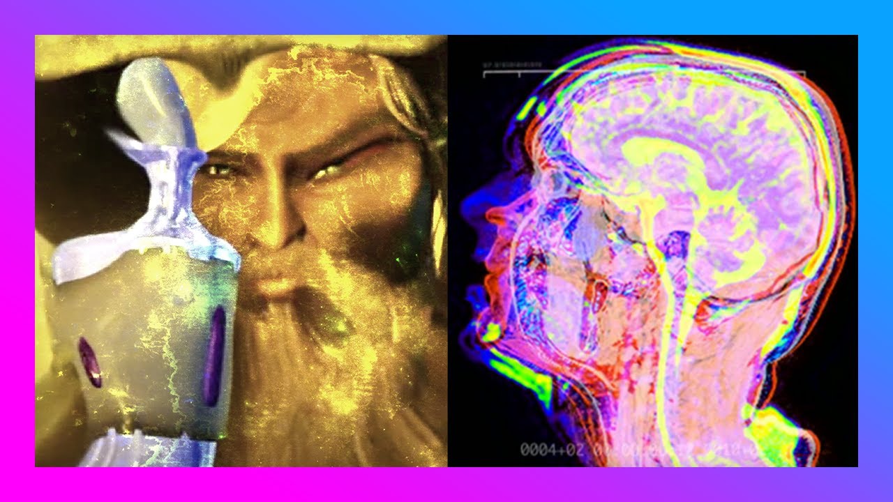 A Man Drank 1 Liter of Skooma. This Is What Happened To His Brain.
