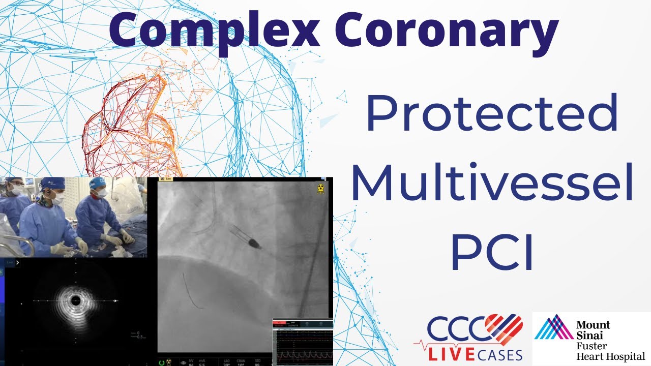 Protected Multivessel PCI