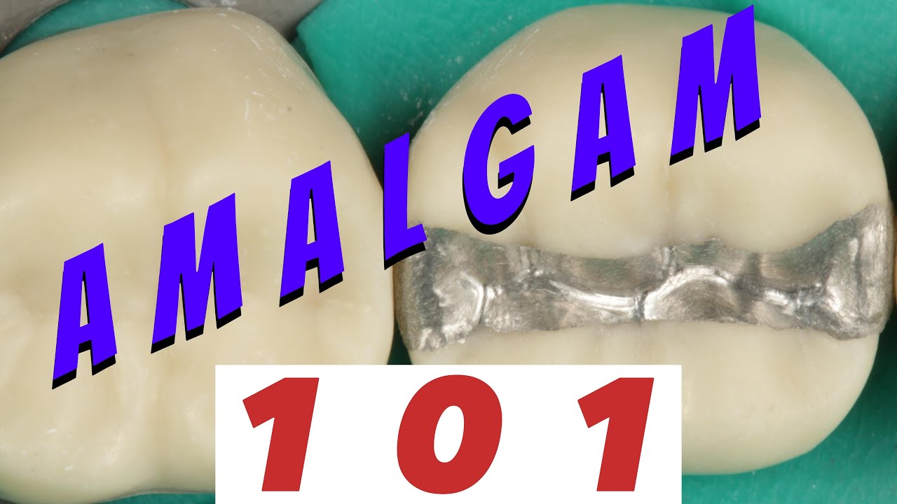 Amalgam restoration steps - MOD