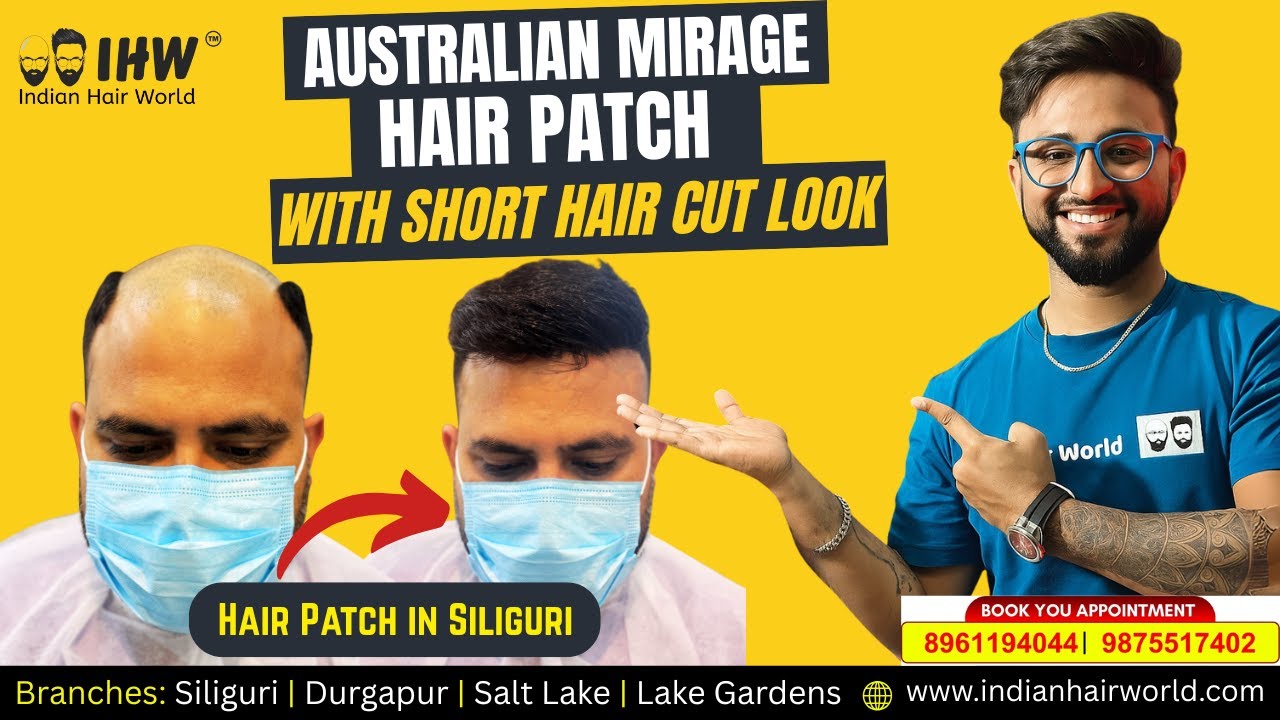 Hair Patch in Siliguri 😱 Instant Transformation with Short Hair Look!