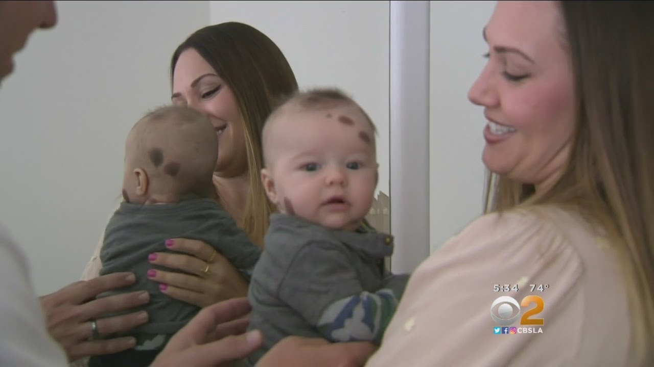 Couple Raising Awareness About Baby's Rare Skin Disorder