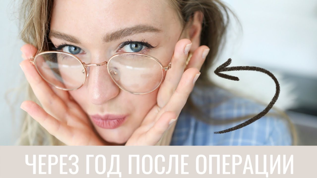 МИНУСЫ И ПЛЮСЫ ЛАЗЕРНОЙ КОРРЕКЦИИ ЗРЕНИЯ