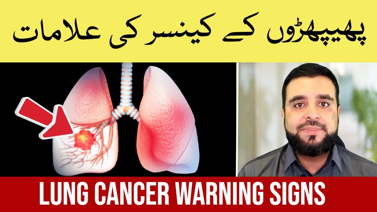 Lung Cancer Symptoms Explained: How to Treat Lung Cancer?  | Phephron Ka Cancer ki Alamat aur Ilaj