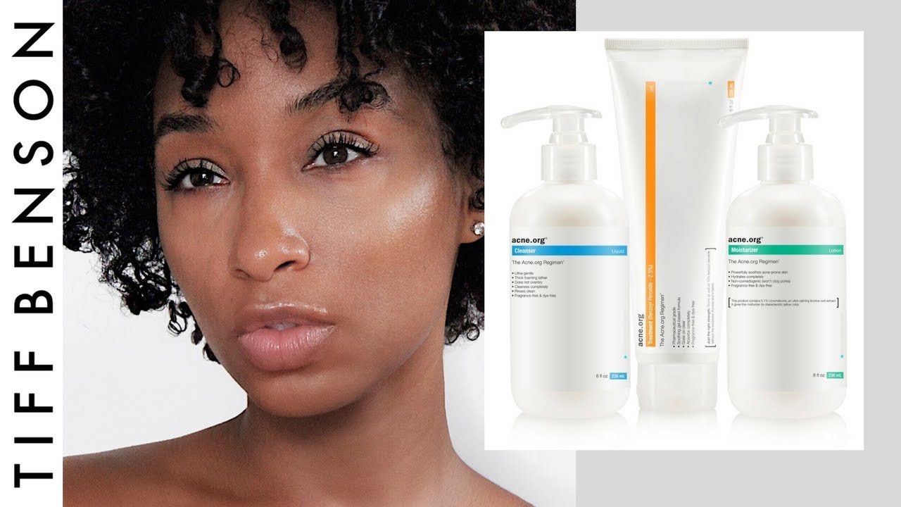Acne.org Regimen | Unsponsored Review with Before and After Pictures