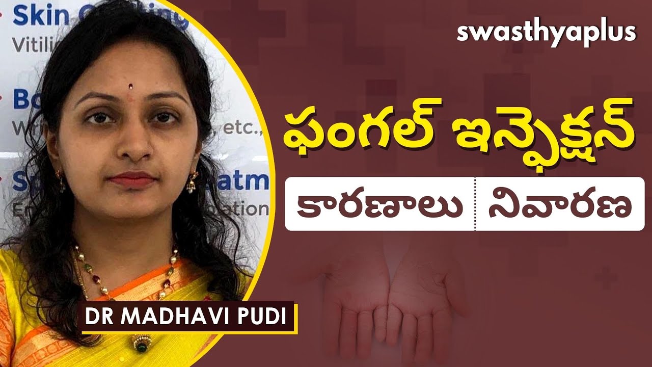 ఫంగల్ ఇన్ఫెక్షన్లు అంటే ఏమిటి? | Fungal Infection in Telugu | Signs & Prevention | Dr Madhavi Pudi
