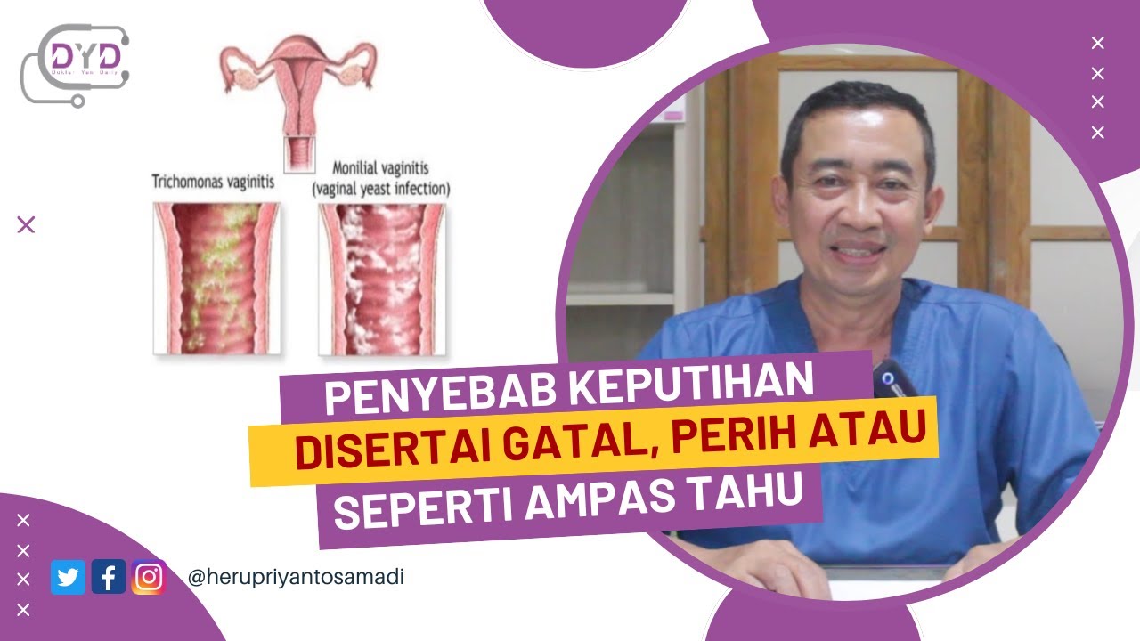 Penyebab Keputihan Disertai Gatal, Perih atau Seperti Ampas Tahu