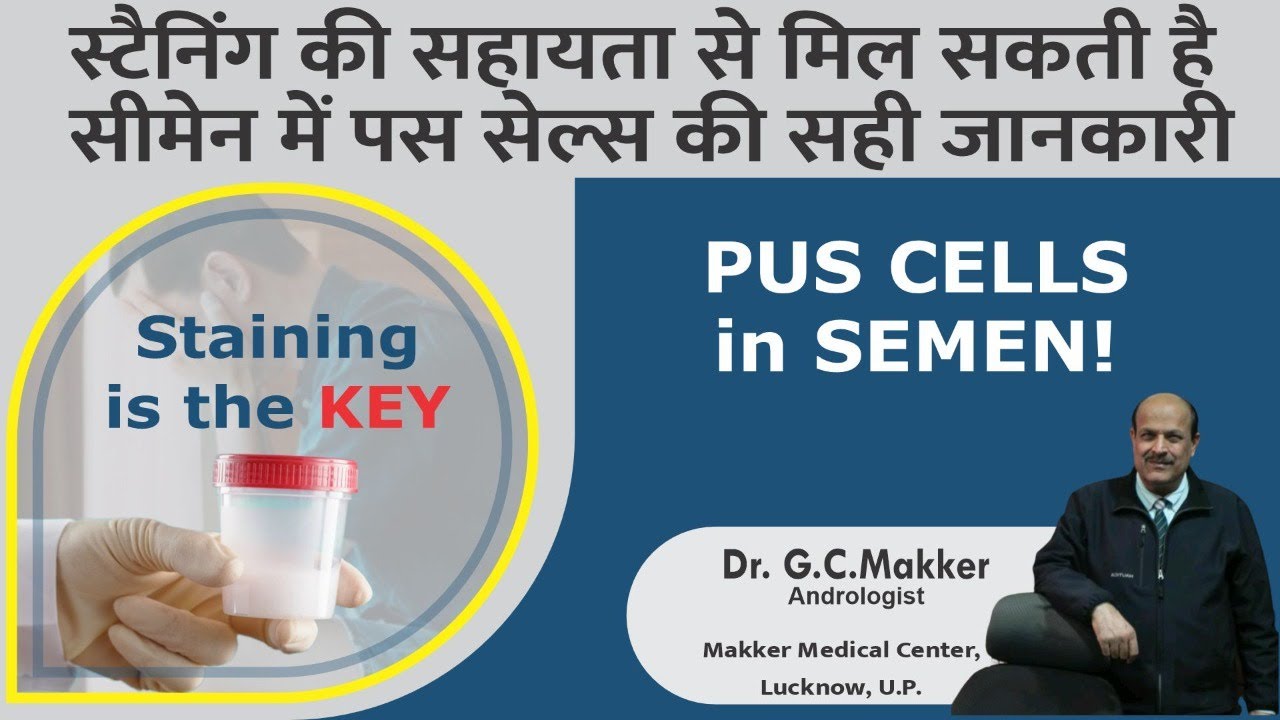 Pus cells in Semen Treatment-