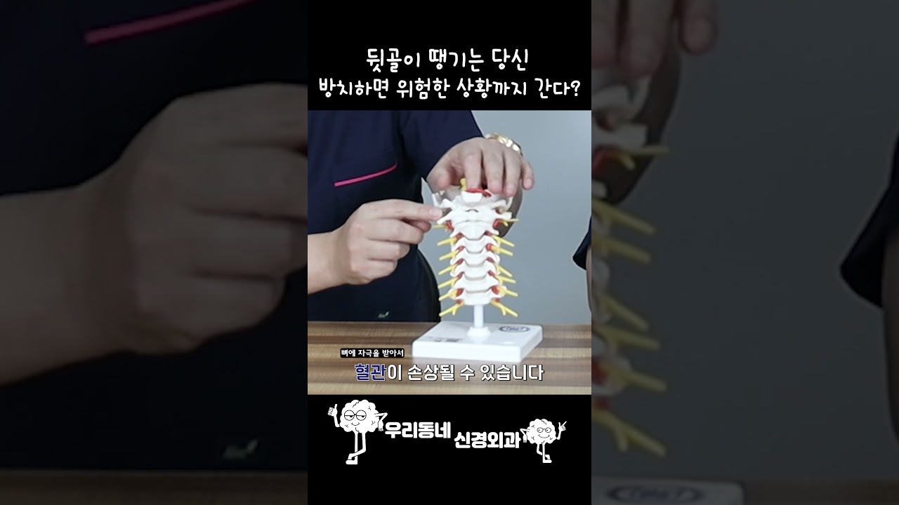 운동 후 뒷골이 땡기면 혈관이 찢어진 상황?  | 의학 전문채널 #shorts