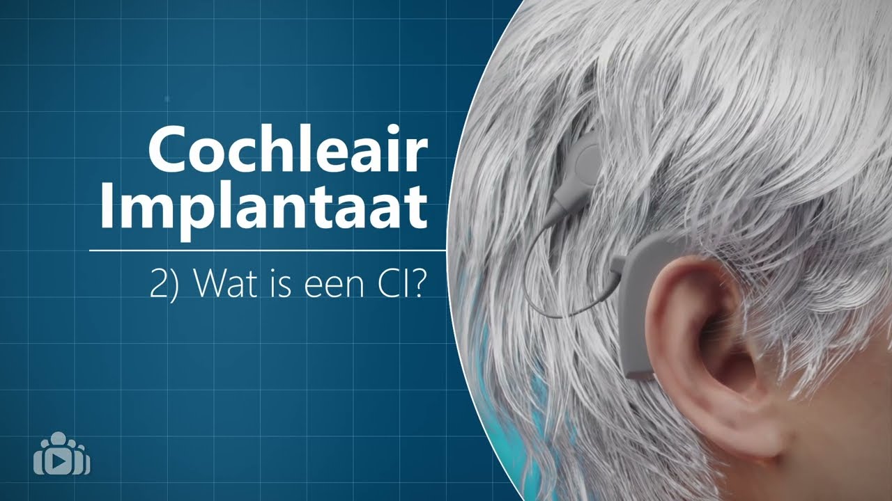 Cochleair Implantaat - Wat is een Cochleair Implantaat (CI)?