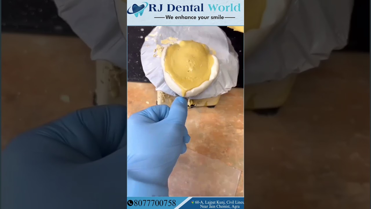 Primary cast for complete edentulous Denture | primary cast making