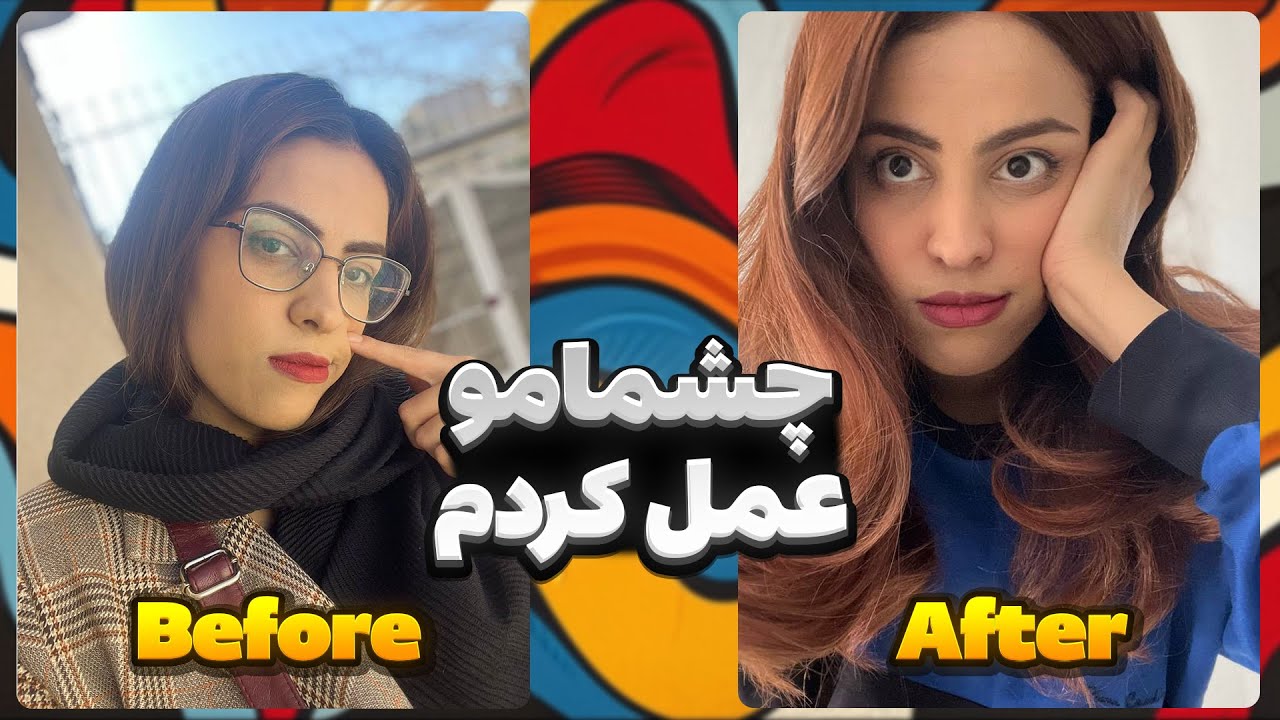 تجربه من از عمل چشم (فمتولیزیک)