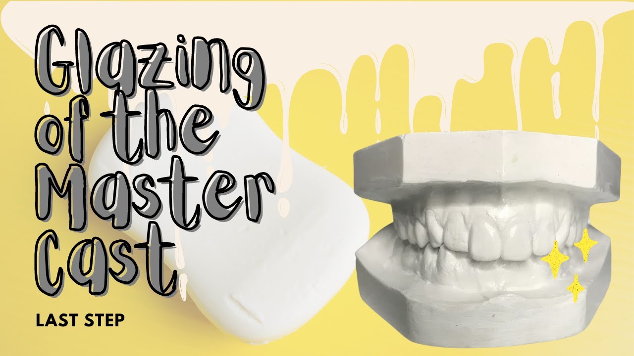 Studentist Diaries 🦷: Ep. 5 Glazing of the Master Cast
