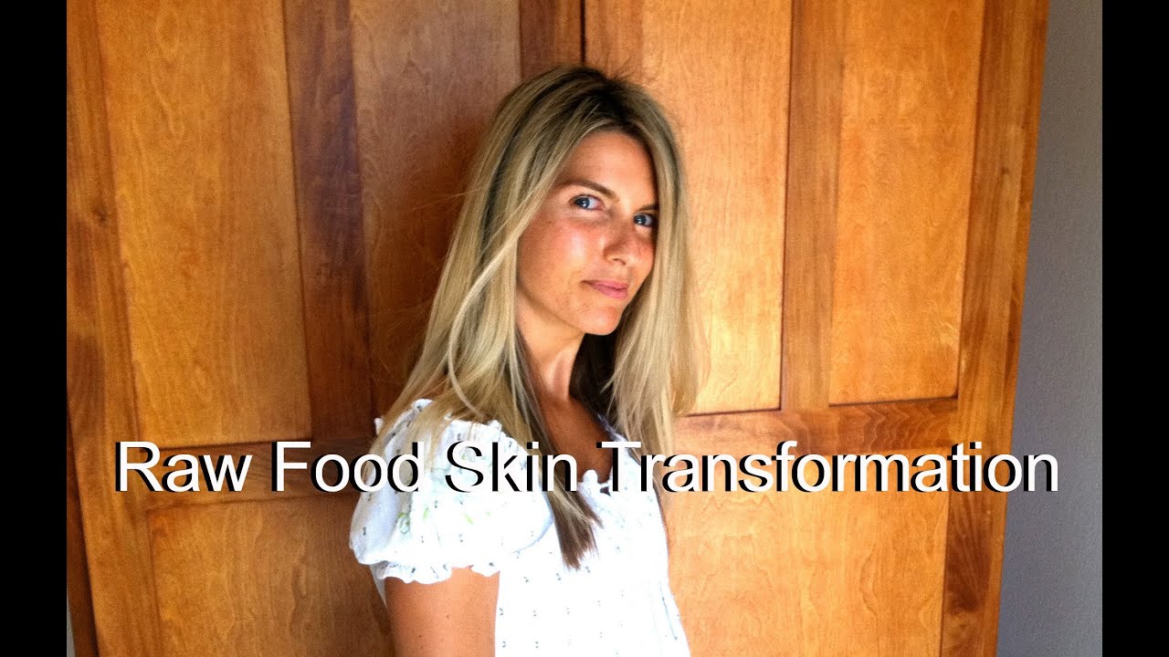 Raw Food Skin Before & After 801010 Transformation (photos)