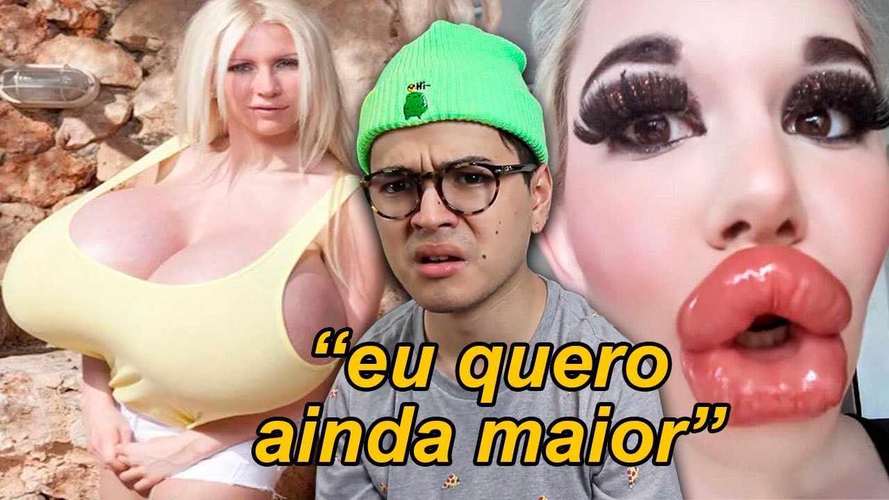 as piores cirurgias feitas por influencers pra ganhar mais likes