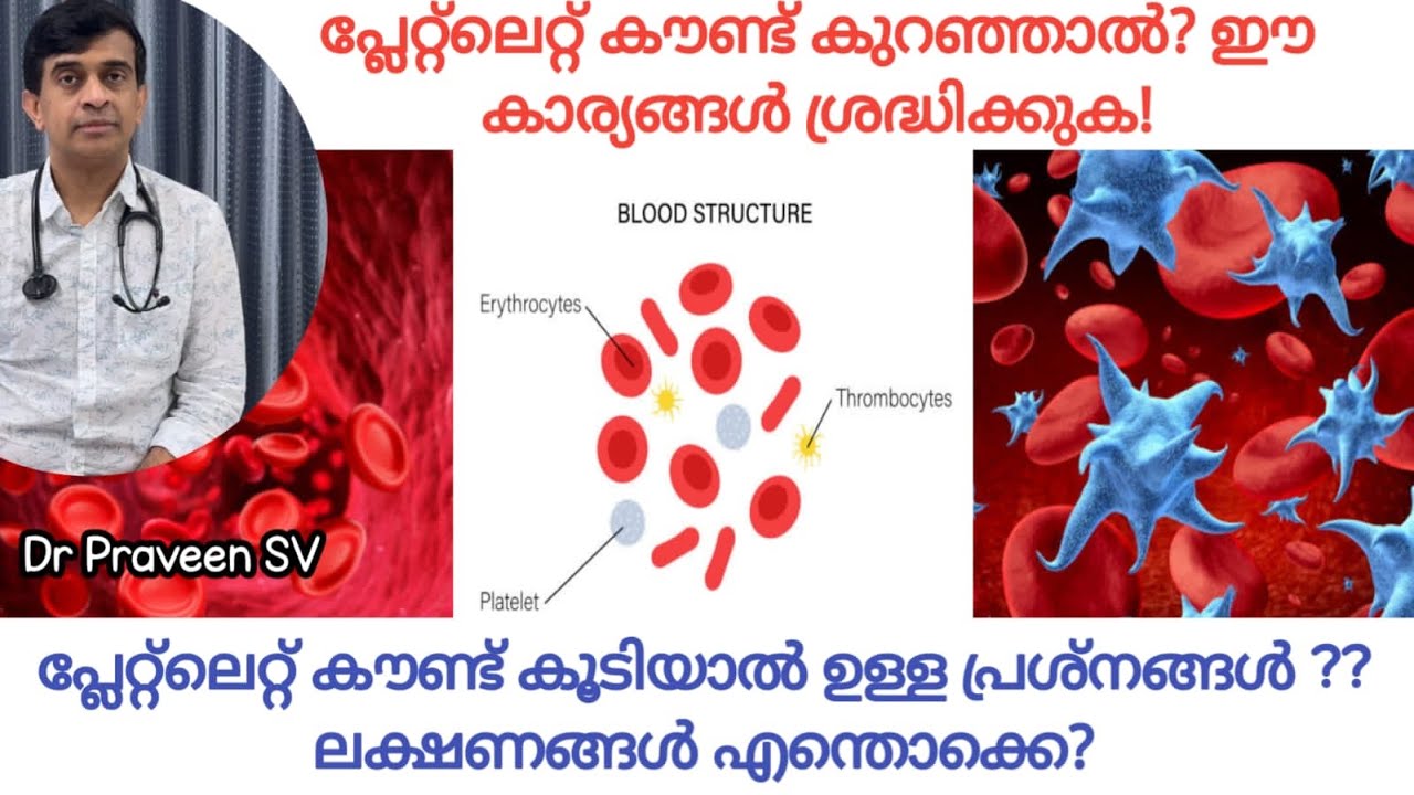 Platelet count malayalam | Platelet count koodiyal malayalam | Platelet count kuranjal malayalam