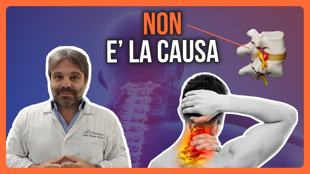 Le ERNIE del DISCO non Sono la CAUSA del DOLORE Cervicale