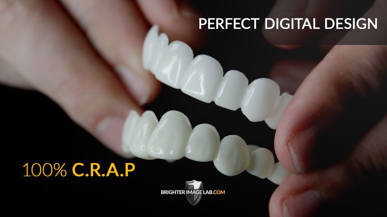 Shiny, Pop-On Veneers V.S Brighter Image Lab 100% Digitally Designed VS Melted Plastic