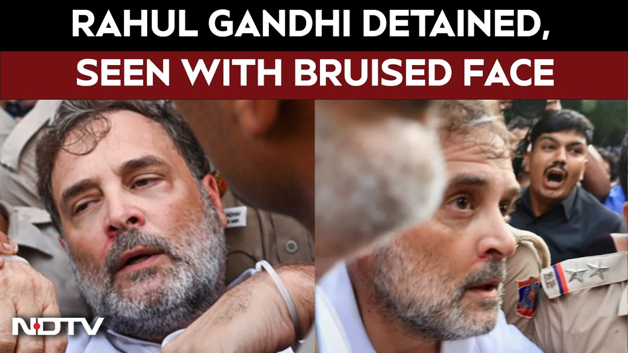 Rahul Gandhi Injured | Rahul Gandhi Detained From Protest Site, Seen With Bruised Face