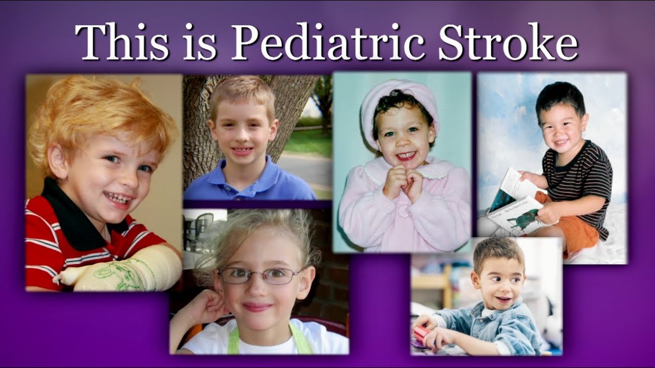 A Stroke Can Happen at Any Age