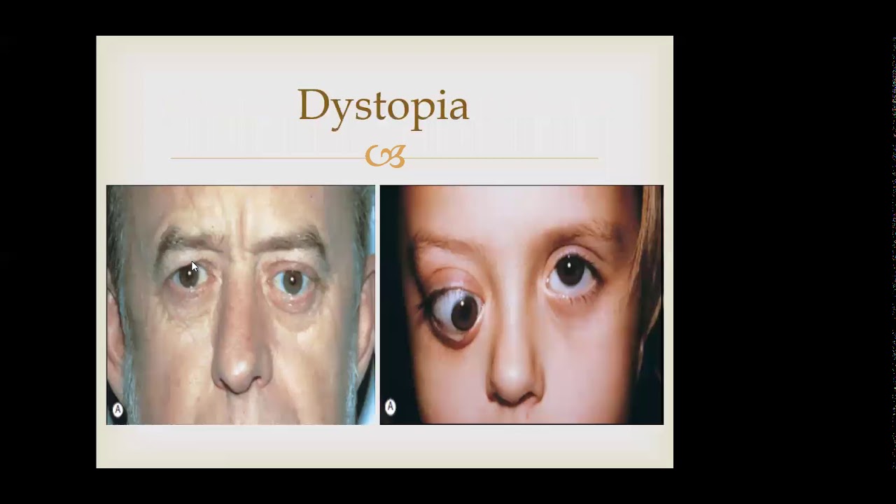 د. معتز حسن / Ophthalmology - The Orbit