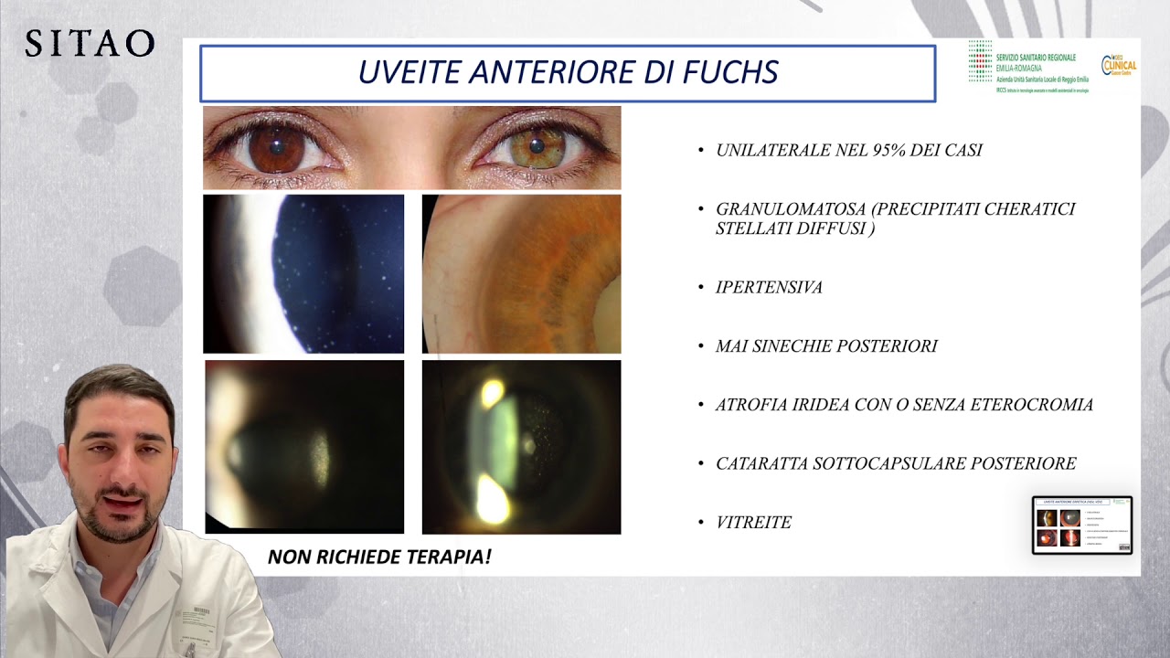 Le Uveiti