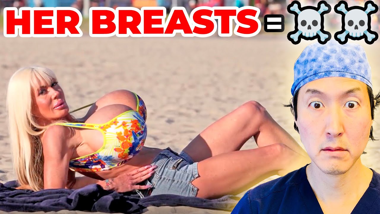 She Has the LARGEST BREASTS Ever!! EXTREME Bodies EXPLAINED!