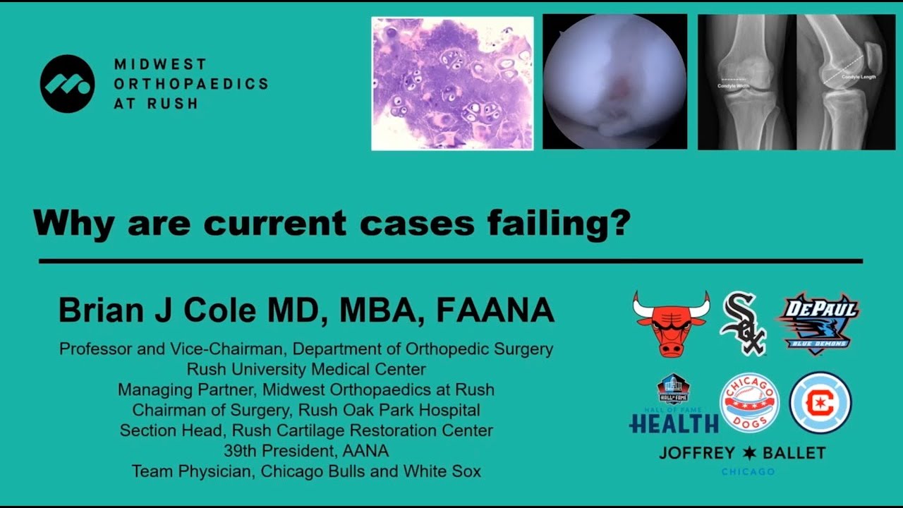 Why are current cases failing? – ICRS 2023