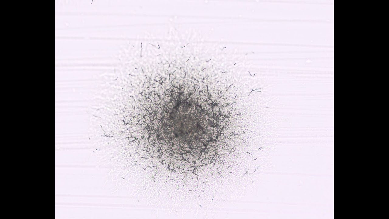 Nocardia spp with aerial hyphae