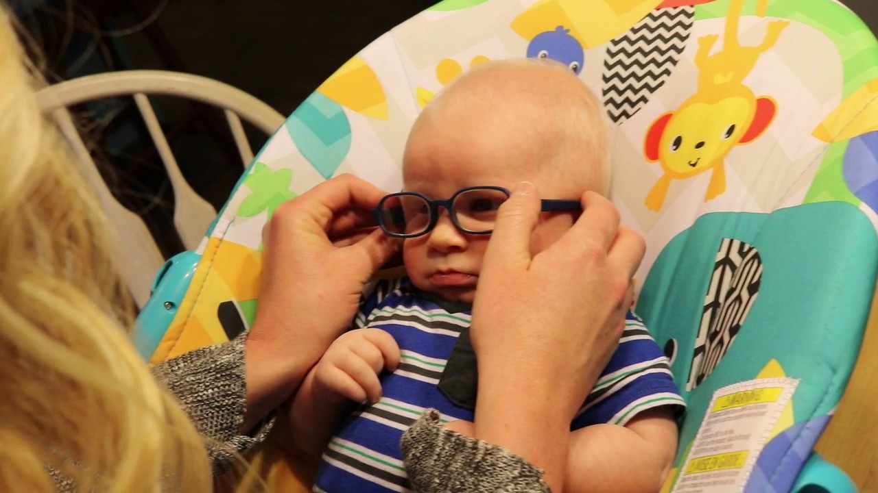 Baby with Albinism Sees Mom for First Time with Glasses