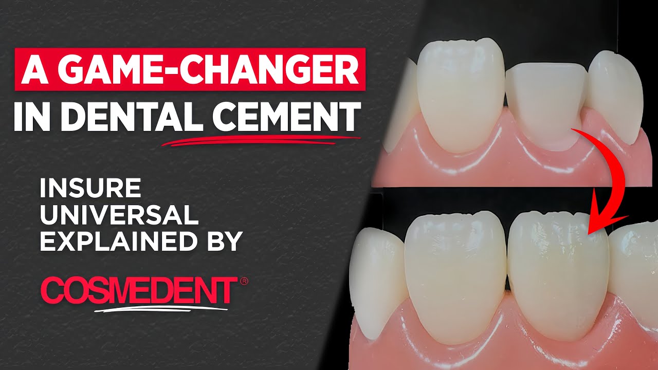 Game-Changer in Esthetic Dentistry! 🌟 INSURE UNIVERSAL Cement by Cosmedent Explained