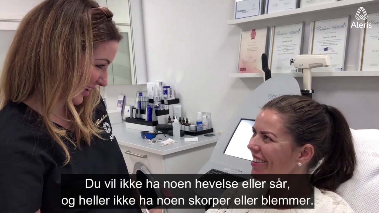 IPL: Behandling mot pigmentering