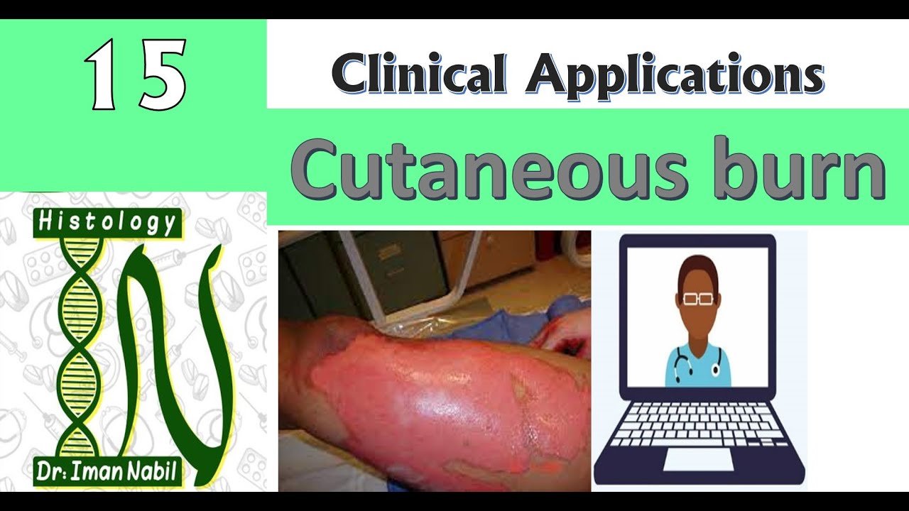 15-Cutaneous burns-درجات الحروق الجلدية -Clinical applications of Histology-Skin