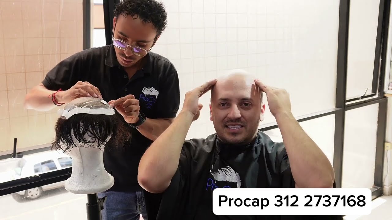ADIOS A LA CALVICIE   PROTESIS CAÌLAR INDETECTABLE