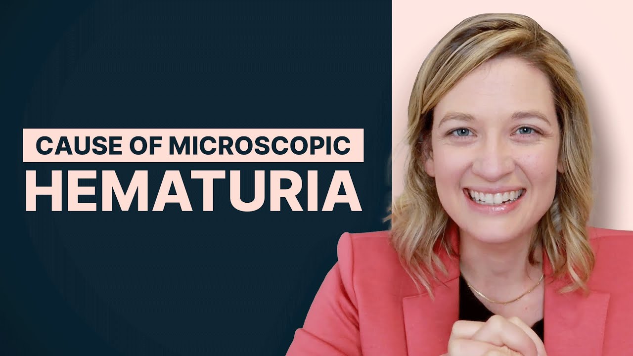 Determining The CAUSE OF MICROSCOPIC HEMATURIA