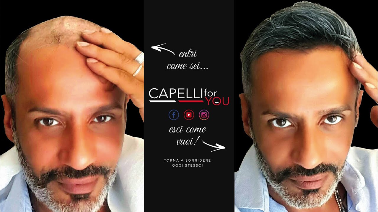Applicazione Protesi Capillare 5° Dimensione Capelli for You