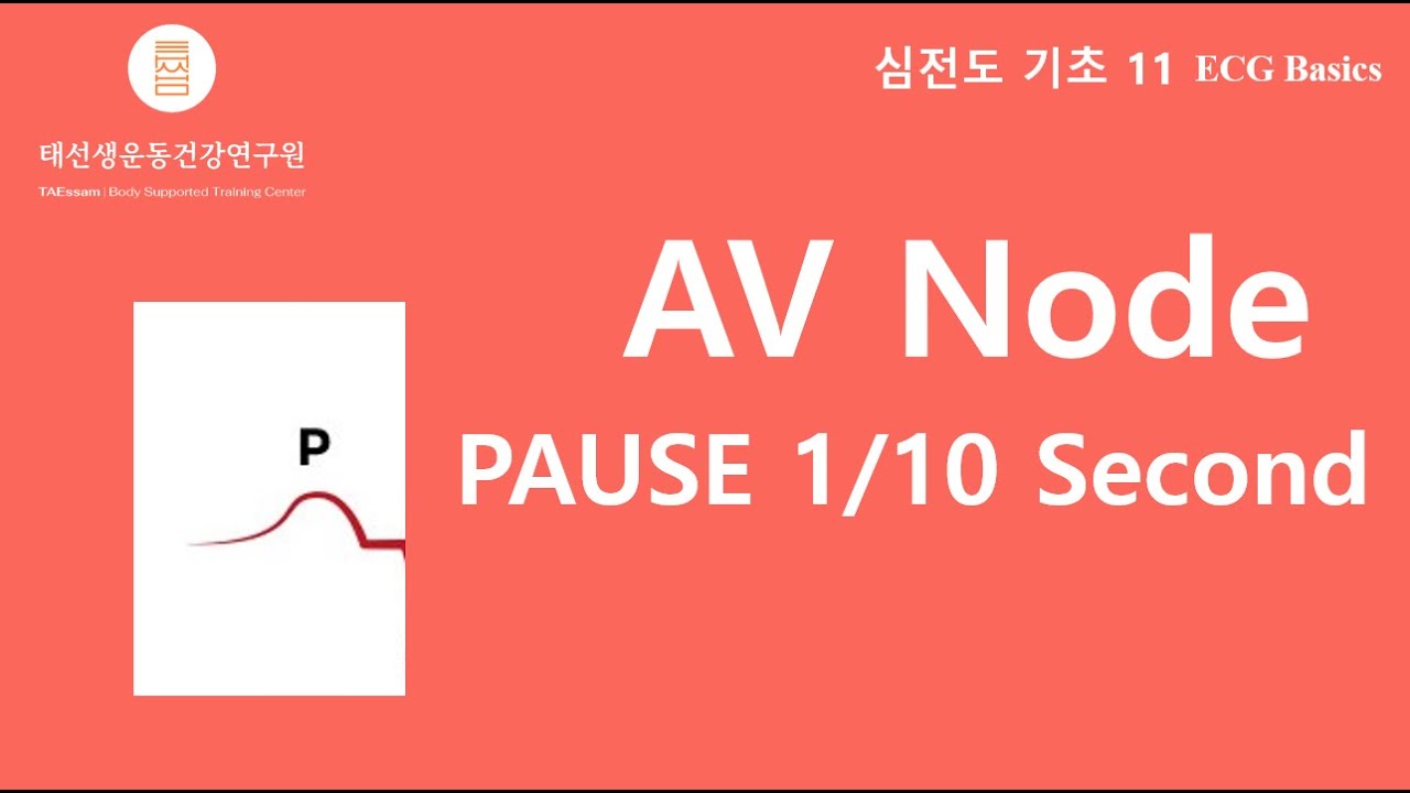 【11th ECG Basics-English Subtitled】 AV Node PAUSE 1/10 Second?