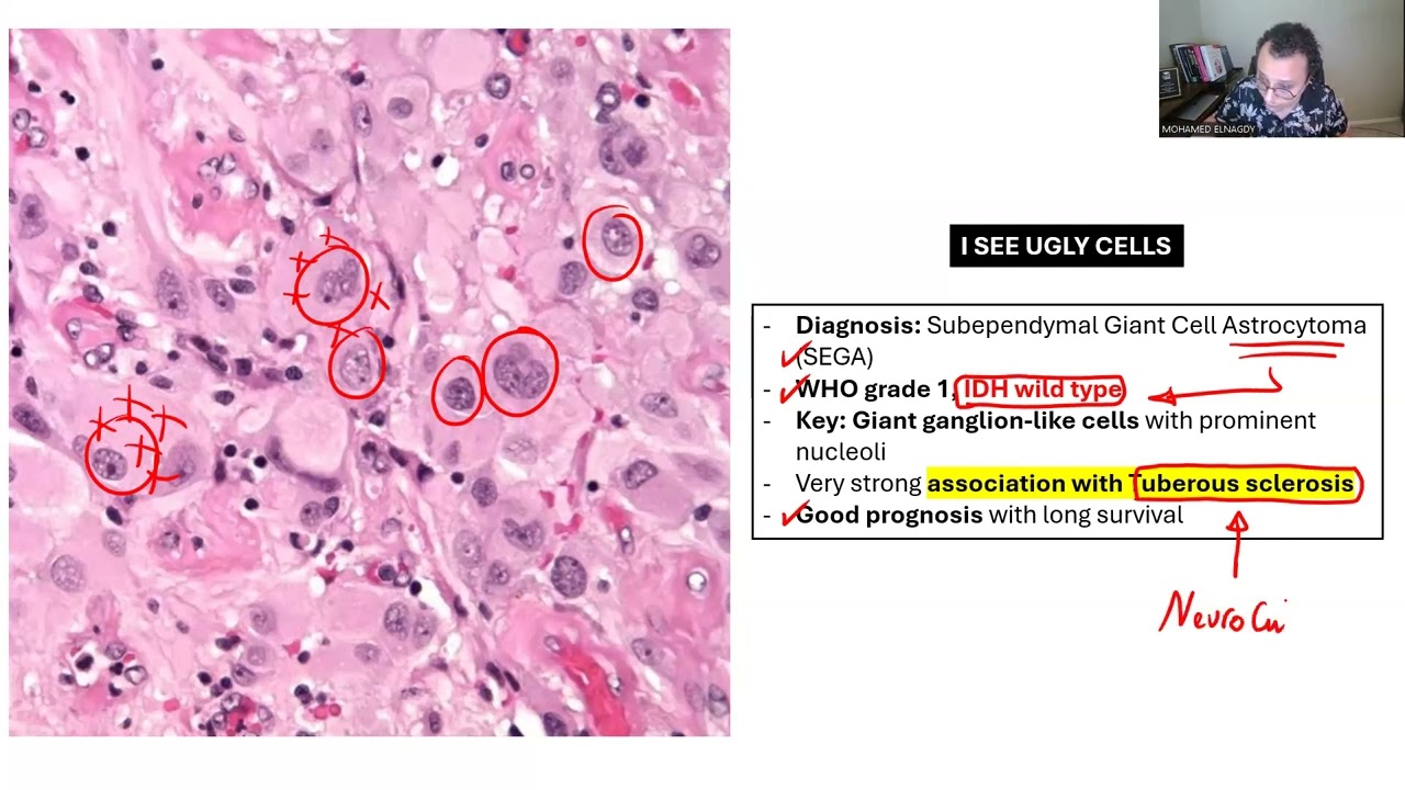 NEUROPATHOLOGY: BOARD REVIEW 2