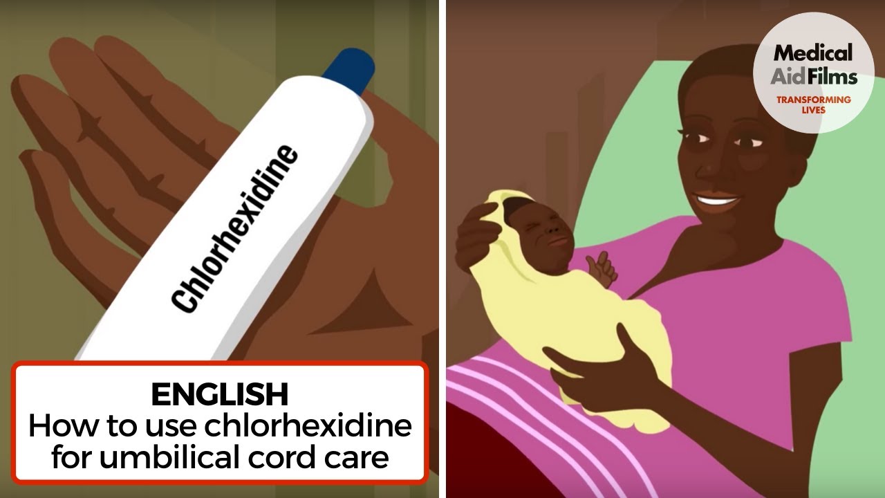 How to use chlorhexidine for umbilical cord care