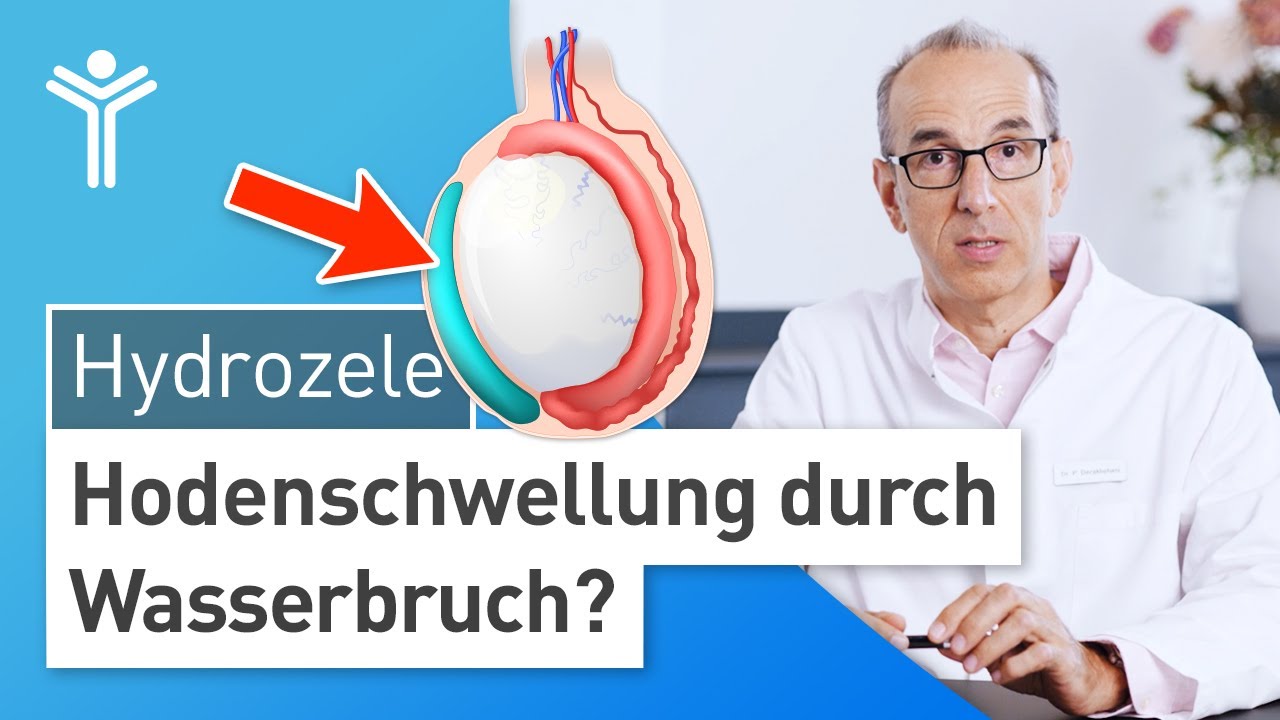 Hydrozele: Hodenschwellung durch Wasserbruch?